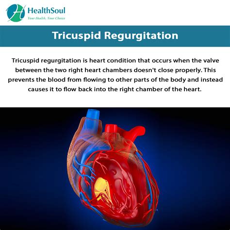 Benefits of a Healthy Lifestyle Tricuspid Stenosis
